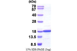 SDS-PAGE (SDS) image for Nucleoside diphosphate kinase B (NME2) (AA 1-152) (Active) protein (ABIN6387709)