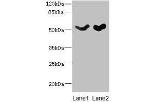 Western blot All lanes: SLC25A25 antibody at 10 μg/mL Lane 1: Mouse liver tissue Lane 2: Mouse brain tissue Secondary Goat polyclonal to rabbit IgG at 1/10000 dilution Predicted band size: 53, 56, 57, 55, 41 kDa Observed band size: 53 kDa (SLC25A25 anticorps  (AA 1-189))