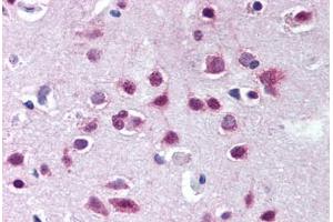 Human Brain, Cortex (formalin-fixed, paraffin-embedded) stained with UBA6 antibody ABIN290255 at 10 ug/ml followed by biotinylated goat anti-rabbit IgG secondary antibody ABIN481713, alkaline phosphatase-streptavidin and chromogen. (UBA6 anticorps  (AA 300-350))