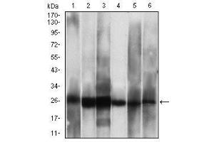 Western blot analysis using CSNK2B mouse mAb against Hela (1), Jurkat (2), C6 (3), MCF-7 (4), SK-N-SH (5), NTERA-2 (6) cell lysate. (CSNK2B anticorps  (AA 1-215))
