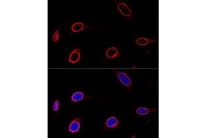 anti-Emerin (EMD) (AA 1-220) antibody