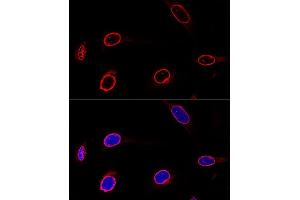 Confocal immunofluorescence analysis of U-2 OS cells using Emerin/Emerin/EMD Polyclonal Antibody  at dilution of 1:100. (Emerin anticorps  (AA 1-220))