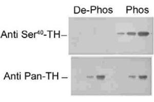Western blot of recombinant phospho- and dephospho-Th showing selective immunolabeling by the phospho-specific antibody of the ~60k Th phosphorylated at Ser40. (Tyrosine Hydroxylase anticorps)