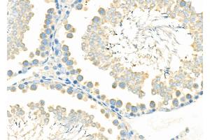 ABIN6265844 and ABIN6276978 at 1/100 staining Rat testis tissue by IHC-P. (UBE2D1 anticorps  (C-Term))