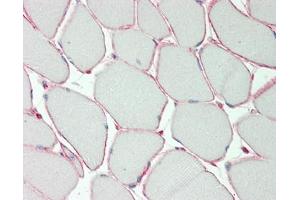 Human Skeletal Muscle: Formalin-Fixed, Paraffin-Embedded (FFPE) (KCNE1-Like anticorps  (AA 67-96))