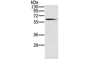 Western Blot analysis of Human fetal brain tissue using SLC45A3 Polyclonal Antibody at dilution of 1:200 (SLC45A3 anticorps)