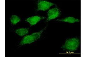 Immunofluorescence of purified MaxPab antibody to SNX11 on HeLa cell. (SNX11 anticorps  (AA 1-270))