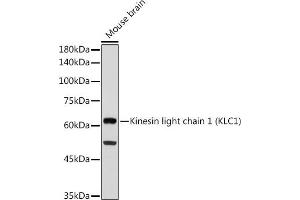 Western blot analysis of extracts of Mouse brain, using Kinesin light chain 1 (Kinesin light chain 1 (KLC1)) antibody (ABIN7268139) at 1:1000 dilution.