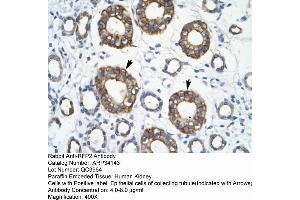 Human kidney (TRIM13 anticorps  (Middle Region))