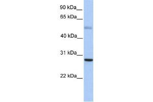 Western Blotting (WB) image for anti-MAX Dimerization Protein 1 (MXD1) antibody (ABIN2458296) (MXD1 anticorps)