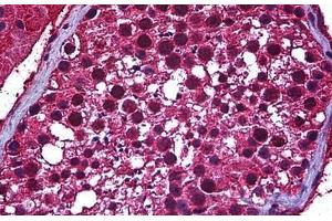 Human Testis: Formalin-Fixed, Paraffin-Embedded (FFPE)