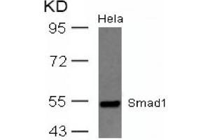 Image no. 2 for anti-SMAD, Mothers Against DPP Homolog 1 (SMAD1) (AA 461-465) antibody (ABIN319351) (SMAD1 anticorps  (AA 461-465))