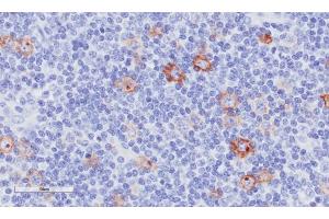 Immunohistochemical staining of human tonsil tissue using anti-CD30 antibody  Ki-3 Anti-CD30 staining of paraffin embedded human tonsil tissue using the rabbit-chimeric version of Ki-3 (ABIN7072328).