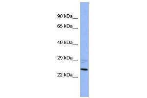 PPM1B antibody used at 1 ug/ml to detect target protein. (PPM1B anticorps)