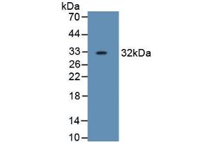 Detection of Recombinant HPR, Human using Monoclonal Antibody to Haptoglobin Related Protein (HPR) (HPR anticorps  (AA 102-347))