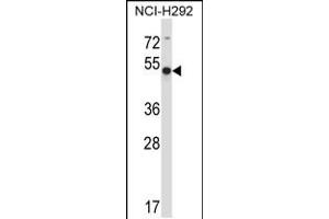 Western blot analysis in NCI-H292 cell line lysates (35ug/lane). (ACTR6 anticorps  (C-Term))