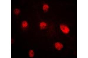 Immunofluorescent analysis of Pr-Set7 staining in MCF7 cells.