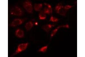 ABIN6275913 staining Hela cells by IF/ICC. (Adenosine A2a Receptor anticorps  (Internal Region))