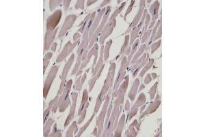 (ABIN6243895 and ABIN6578867) staining MYL1 in human heart tissue sections by Immunohistochemistry (IHC-P - paraformaldehyde-fixed, paraffin-embedded sections). (MYL1 anticorps  (AA 24-58))