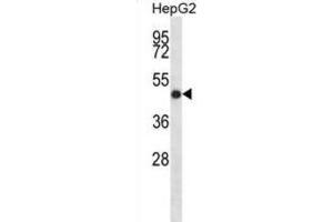 Western Blotting (WB) image for anti-Indian Hedgehog (IHH) antibody (ABIN2998360)