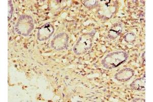 Immunohistochemistry of paraffin-embedded human small intestine tissue using ABIN7176140 at dilution of 1:100 (ZNF19 anticorps  (AA 1-200))