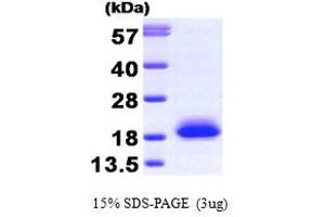 SDS-PAGE (SDS) image for Visinin-Like 1 (VSNL1) (AA 1-191) protein (ABIN666662)