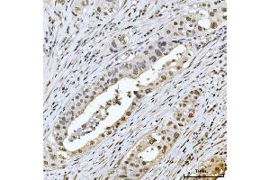IHC analysis of MRE11 using anti-MRE11 antibody (ABIN7600025). (Mre11 anticorps  (AA 14-481))