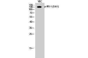 Western Blotting (WB) image for anti-Insulin Receptor Substrate 1 (IRS1) (pSer307) antibody (ABIN3182046) (IRS1 anticorps  (pSer307))