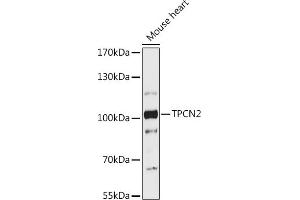Western blot analysis of extracts of Mouse heart, using TPCN2 antibody (ABIN7271111) at 1:1000 dilution. (TPCN2 anticorps  (AA 11-85))