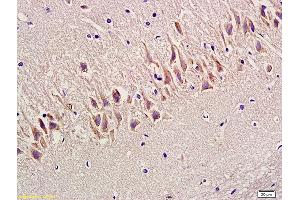 Formalin-fixed and paraffin embedded rat hippocampus labeled with Anti-SYN1/Synapsin 1 Polyclonal Antibody, Unconjugated (ABIN747263) at 1:300 followed by conjugation to the secondary antibody and DAB staining (SYN1 anticorps  (AA 201-300))