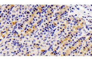 Detection of AXIN in Rat Stomach Tissue using Polyclonal Antibody to Axis Inhibition Protein (AXIN)
