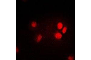 Immunofluorescent analysis of Thymopoietin staining in HepG2 cells.