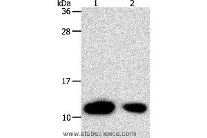 Western blot analysis of Hela cell and human liver cancer tissue, using TXN Polyclonal Antibody at dilution of 1:700 (TXN anticorps)