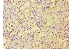 Immunohistochemistry of paraffin-embedded human pancreatic tissue using ABIN7151000 at dilution of 1:100 (CBLC anticorps  (AA 245-474))