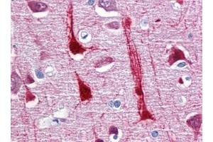 Immunohistochemistry (IHC) image for anti-Crystallin, mu (CRYM) (AA 215-315) antibody (ABIN614593)