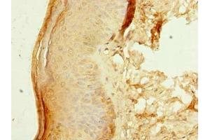 Immunohistochemistry of paraffin-embedded human skin tissue using ABIN7176485 at dilution of 1:100