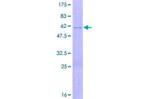 Image no. 1 for Advanced Glycosylation End Product-Specific Receptor (AGER) (AA 1-237) protein (GST tag) (ABIN1317325)
