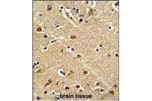 Formalin-fixed and paraffin-embedded human brain tissue reacted with ZWINT Antibody (Center), which was peroxidase-conjugated to the secondary antibody, followed by DAB staining.