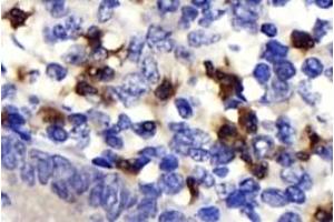 Immunohistochemistry analysis of paraffin-embedded human epityphlon using,NK-p44 (ABIN7074778) at dilution of 1: 500 (NKp44/NCR2 anticorps)