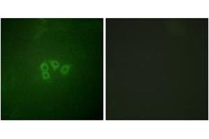 Immunofluorescence analysis of A549 cells, using eIF4B (Ab-422) Antibody. (EIF4B anticorps  (AA 388-437))