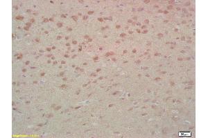 Formalin-fixed and paraffin embedded rat brain labeled with Anti-MST1 Polyclonal Antibody, Unconjugated (ABIN747308) at 1:200, followed by conjugation to the secondary antibody and DAB staining