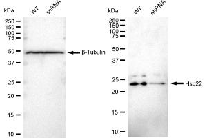 Western blotting analysis using Hsp22 antibody (ABIN7798842).