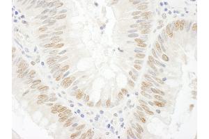 Immunohistochemistry (IHC) image for anti-BRCA2 and CDKN1A Interacting Protein (BCCIP) (AA 300-350) antibody (ABIN7448933) (BCCIP anticorps  (AA 300-350))