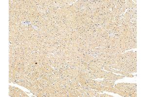 ABIN7094628 and ABIN7098678 at 1/100 staining Rat heart tissue by IHC-P. (LOXL2 anticorps  (Internal Region))