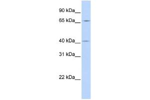 WB Suggested Anti-CCDC138 Antibody Titration: 0. (CCDC138 anticorps  (N-Term))
