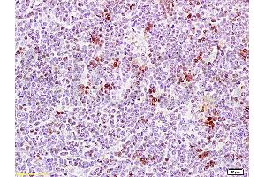 Formalin-fixed and paraffin embedded rat thymus tissue labeled Anti-PCNA Polyclonal Antibody, Unconjugated (ABIN672756) at 1:200, followed by conjugation to the secondary antibody and DAB staining (PCNA anticorps  (AA 185-261))