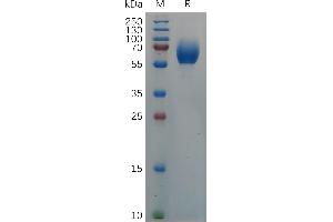 Cynomolgus IL18BP Protein, hFc Tag on SDS-PAGE under reducing condition.