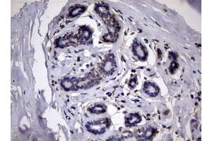 Image no. 2 for anti-Ribonucleotide Reductase M1 (RRM1) (AA 541-792) antibody (ABIN1491583)