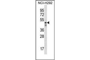 Western blot analysis of PDZK1 Antibody (Center) in NCI-H292 cell line lysates (35ug/lane). (PDZK1 anticorps  (Middle Region))