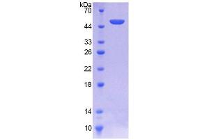 SDS-PAGE analysis of Human SPINT2 Protein.